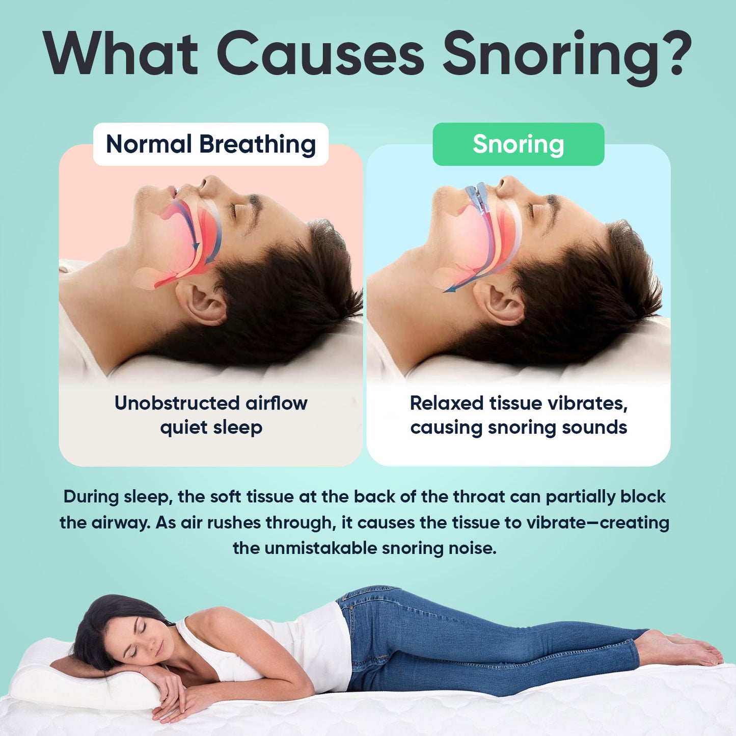 Anti Snore Mouth Guard + 30 Days Supply Of Nasal Strips - SleepRelief